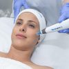 جلسات DERMAPEN